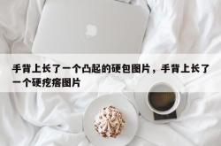 手背上长了一个凸起的硬包图片，手背上长了一个硬疙瘩图片